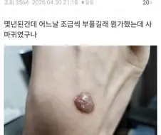 티눈갤보는데 ㅅㅂ 존나웃기네ㅋㅋㄱㄱㅋ