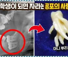 신체 부위중 가장 병 신같은 부위