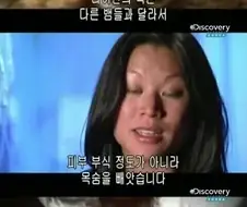 [극혐] 최악의 날에 뱀한테 물려서 죽을뻔한 사람.jpg