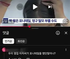 옆집 아저씨가 머머리가 된 이유