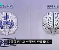 화를 참으면 우울증, 화를 내면 심장병