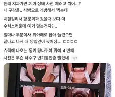 치과가면 사진 원래 이렇게 찍냐.jpg