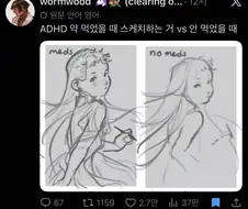 adhd약 먹었을 때랑 안 먹었을때