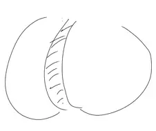 찌플레이션으로 일어나고있는 부작용