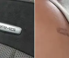 차에 탔다가 등에 ＇AMG 로고 모양＇ 화상…