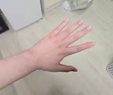 자위계의 졸트라크