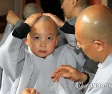 머리선이 보이지만 탈모걱정 없는 사람들