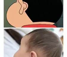 짱구 두상 실사