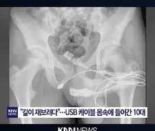 끼야아아아ㅏ아아아아ㅏ아아앙아악!!!!!!!!!!