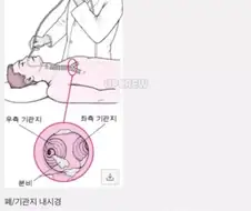 병원에서 겪은 인생 최악의 고통 TOP 1.jpg