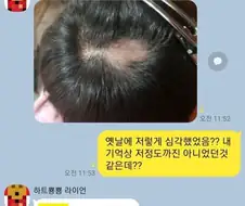탈모인 친구의 고민