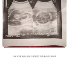 어린이날 걸그룹 대참사