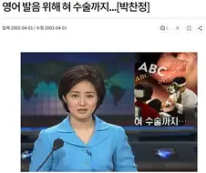 20-30년전 강남에서 유행했던 수술