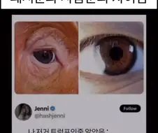 돼지 눈과 사람 눈의 차이점.jpg