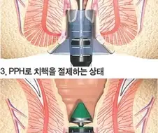 입구 조사 결과 발표