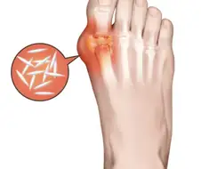 "발에 통풍 잘 들게 해주세요"