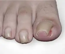 이거 자가치료하면 관우로 인정 받음