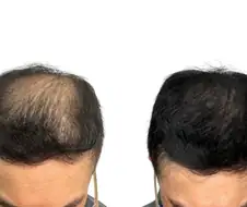 사회적으로 용인되는 문신