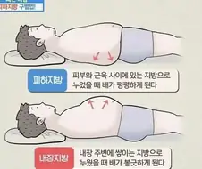 피하지방과 내장지방의 차이