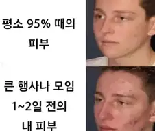 약속날 피부상태 공감