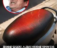 폭염에 스쿠터 안정에 앉았다가 고환이 터진 인도 남성