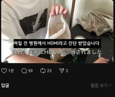 "며칠 전 병원에서 HDMI라고 진단 받았습니다"