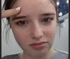 눈과 눈썹 간격을 벌려주는 수술 원리.jpg