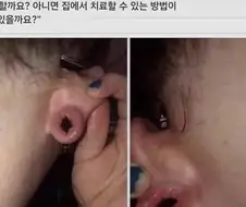 귓구멍에 좋 박았냐?