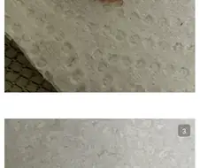 극혐) 티눈갤은 날마다 새로운 미1친놈이나와ㅋㅋㅋㄱ