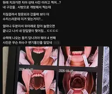 치과 굴욕샷