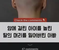 암에 걸린 아이를 놀린 딸의 머리를 밀어버린 아빠