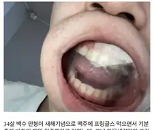 프링글스 뚜껑으로 장난치다 ㅈ된 아저씨.jpg