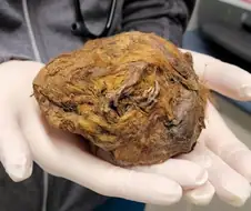 웅크려 겨울잠 자다가 그대로 미이라가 된 3만년전 다람쥐