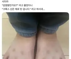여름이면 유행한다는 피부병