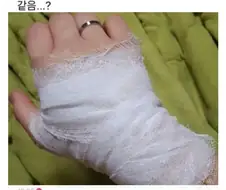 손목 다쳤다고 거짓말해야 하는데