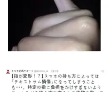 핸드폰 때문에 새끼손가락 변형 온 사람들의 모임.jpg