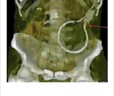 (약혐) 장어와 합체하는 사람들.jpg