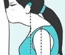 후방) 건전한 거북목의 예시.manga