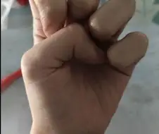 수련의 성과