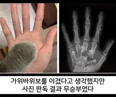 고양이 앞발의 비밀