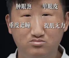 ???: 어머 고객님 수술 너므 잘되셨다 ㅎㅎ