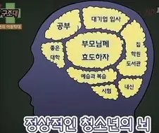 정상적인 뇌vs게임을 하는 뇌