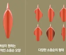 소음순 정리