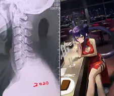 그림 실력을 얻고 건강을 잃다