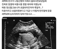 임신했다는 친구의 초음파 사진.jpg