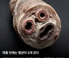 탯줄이야기.