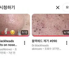 징그럽지만 보게 되는 영상