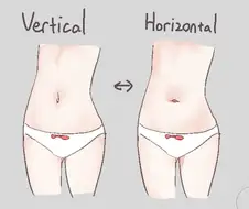은근히 취향이 갈리는 배꼽 형태