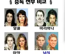 중독자 전후사진 비교