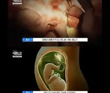 태교를 반대한다는 의사 jpg.